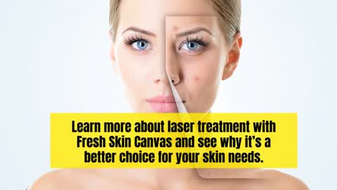 A Complete Guide To Laser And Skin Treatments