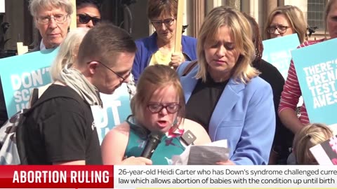 Down's Discrimination - They asked 80 yr old mom if she wants a DNR order for her Downs Son