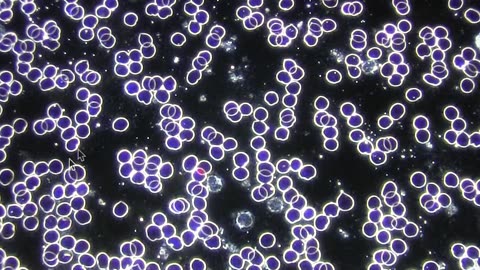 Amazing! Healy's Effect on Blood Cells After Just a 1 Hour Program!