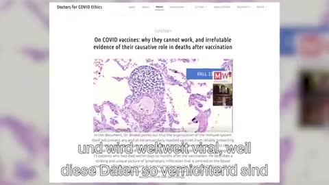 Autoimmunreaktionen nach Covid-19-Impfung