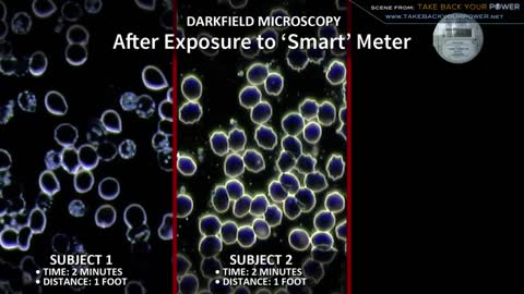 Must Watch! Smart Meters and Health effects