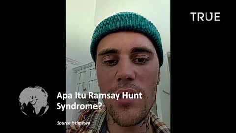 Mengenal Sindrom Ramsay Hunt Justin Biber