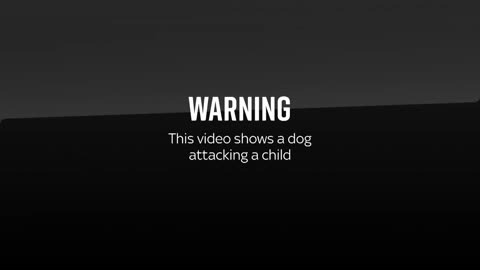 Home sec seeks advice on banning American XL bully breed after dog attacks 11-year-old girl