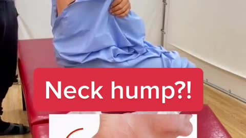 Neck hump?