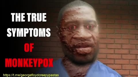 George Floyd Creepypastas: THE TRUE SYMPTOMS OF MONKEYPOX