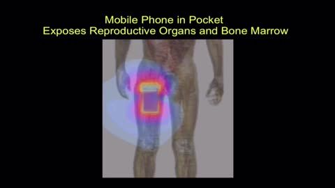 You no longes know your mobile phone os killing your reproductive system😱