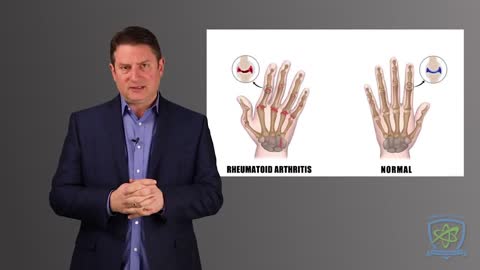 Rheumatoid Arthritis and Hydrogen-rich Water