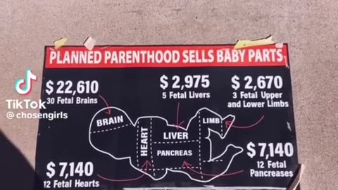 Planned Parenthood Selling Baby Parts