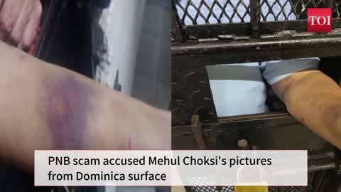 PNB scam accused Mehul Choksi's pictures from Dominica surface