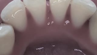 Are you still worried about cleaning your teeth and drinking down the water? (End)