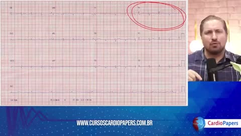 Aula 3 - Dominando o roteiro para interpretar um ECG