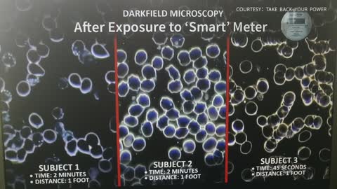 smart meter and degradation of Oxygen in human cells