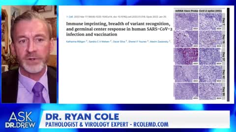 "Długie skrzepy krwi" z mRNA, mówi patolog dr Ryan Cole z dr Kelly Victory - zapytaj dr Drew
