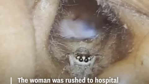 A SPIDER REMOVED FROM A WOMAN’S EAR