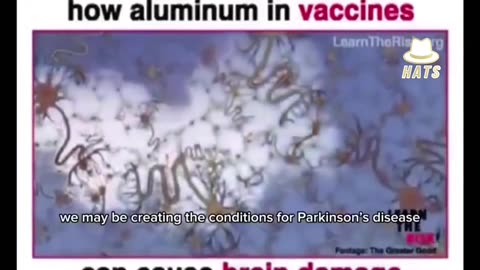 How aluminum in vaccine can cause brain damage.