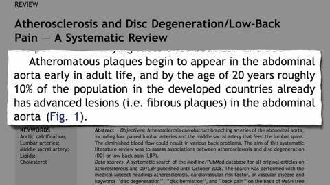 High Cholesterol and Lower Back Pain