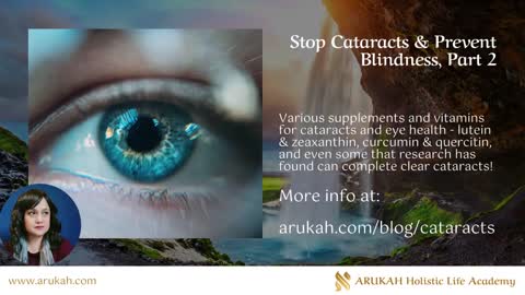 Stop Cataracts & Prevent Blindness, Part 2 - Home Remedies