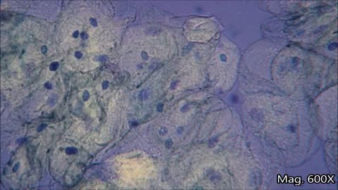 Cheek Cells Under Microscope