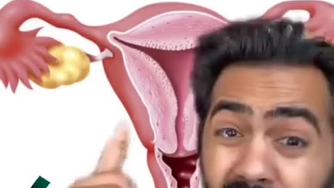 Why do period hurts? Watch and know why very important