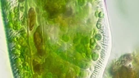 Paramecium Bursaria Eating Cyanobacteria