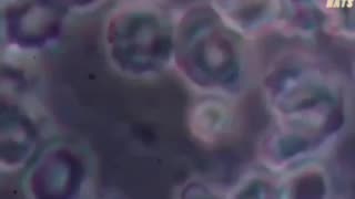 analysis of an unvaccinated person and vaccinated person’s blood under a microscope.
