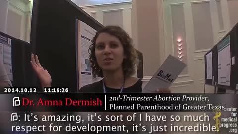 Planned Parenthood TX Abortion Apprentice Taught Partial-Birth Abortion to "Strive For" Intact Heads
