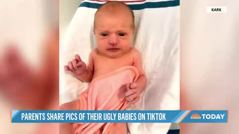 Mom goes viral with "ugly baby"