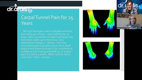 The Solution for Carpal Tunnel Syndrome: WAVwatch Review
