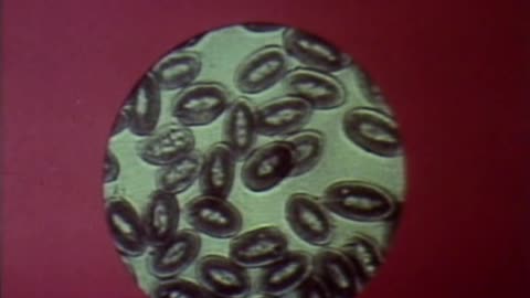 World Without Cancer: The Story of Laetrile (Vitamin B17) (1973 Video)