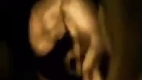 3D ultrasound of baby in womb