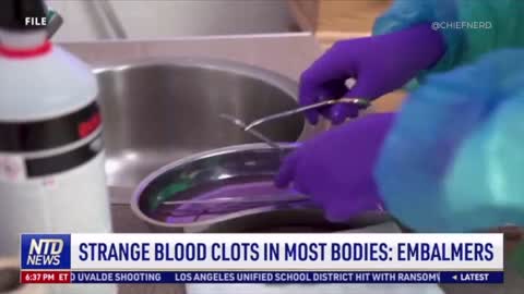 Embalmers Finding Huge Bloodclots in 50-70% of Bodies One Doctor Reported