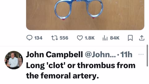 John Campbell Clot Shot 💉🤬