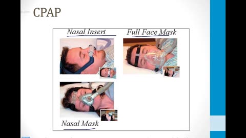 Pulmonary - 3. Other Pulmonary Topics - 4.Sleep Apnea