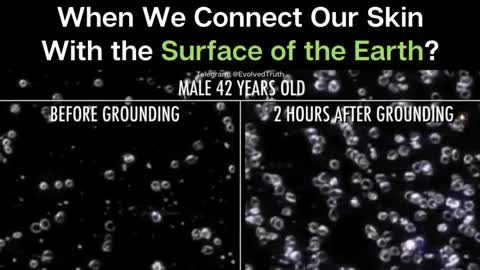 What Happens When We Connect Our Skin With the Surface of the Earth?