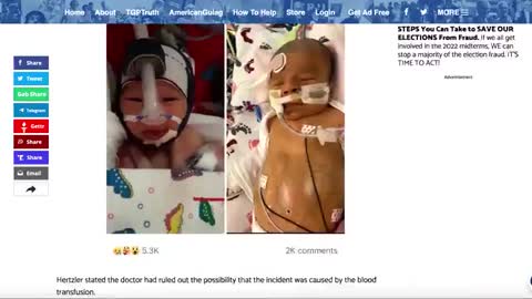BABY HAS DIED OF BLOOD CLOT AFTER VACCINATED BLOOD TRANSFUSION !! AGAINST PARENTS WISHES !!