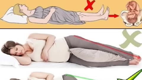 Best sleeping positions for women during pregnancy