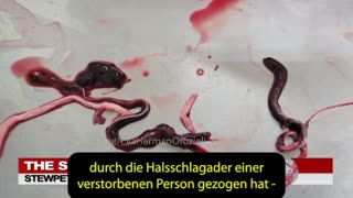 Haarsträubend: Forscher entdecken Mikrotechnik im Blut Geimpfter 🐑🐑🐑COV ID1984-GENOZID