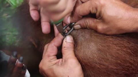 Rescued orangutan gets cut free after being chained for two years!
