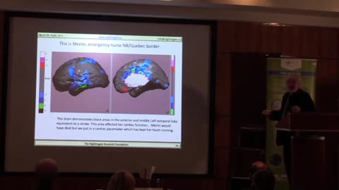 Who Knows How To Test For M.E. ? SPECT SCANS - Byron Hyde MD