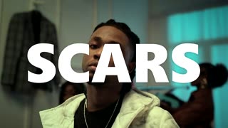 [FREE] Rema x Omah Lay x Burna Boy x Wizkid x Tems x Type Beat - "Scars" | UK Instrumental 2023