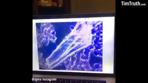 VACCINATED BLOOD UNDER THE MICROSCOPE MUST SEE!