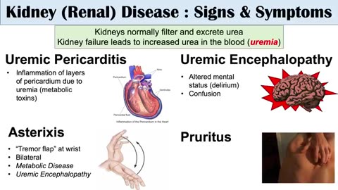 HOW TO CURE YOUR KIDNEY FAILURE.