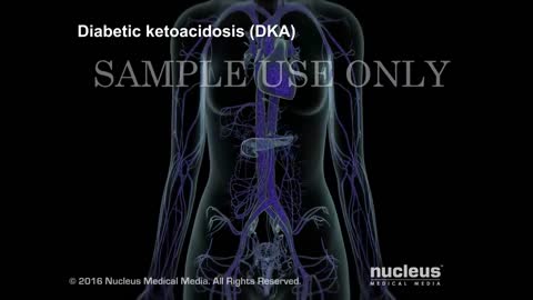 Symtoms and Treatment of Diabetes