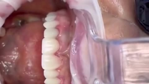 To Whiten Your Teeth in Less Than 16 Minutes Click on the Video Description