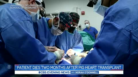 Man dies 2 months after pig heart transplant