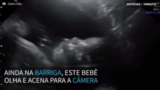 Bebê olha para câmera e acena durante ultrassom
