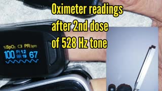 Oximeter readings after 2nd dose of 528 Hz tone