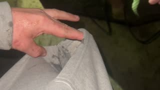 Crayfish Clutches onto Man's Finger
