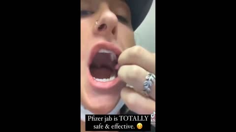 BREAKING : Vaxxed Lady Develops Huge Busted Blood Vessels Inside Mouth & On Body