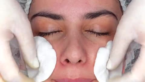 Limpieza Facial